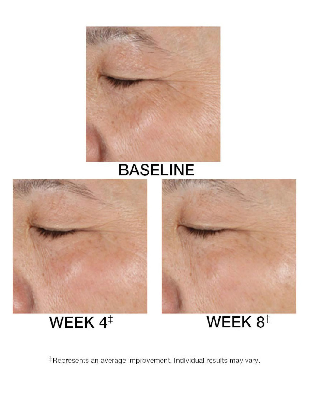 1.5 FL. OZ. Serum T801