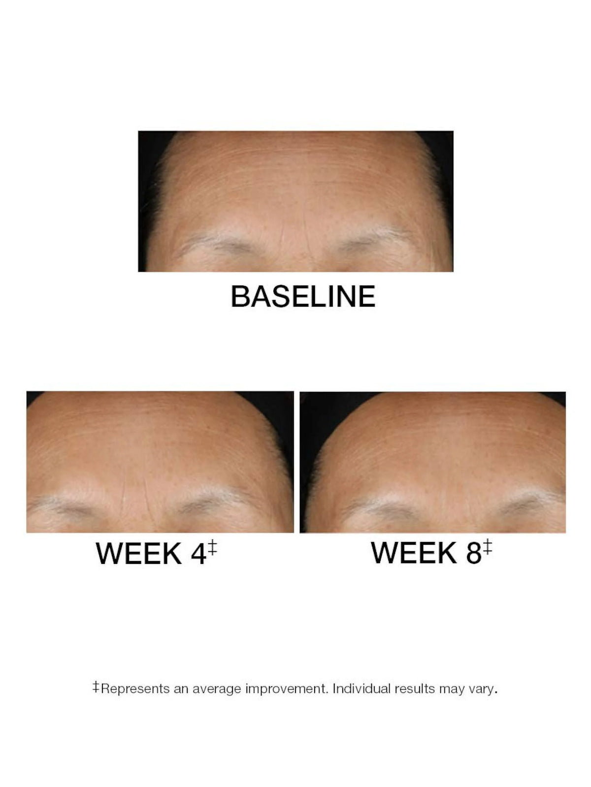 1.5 FL. OZ. Serum T801