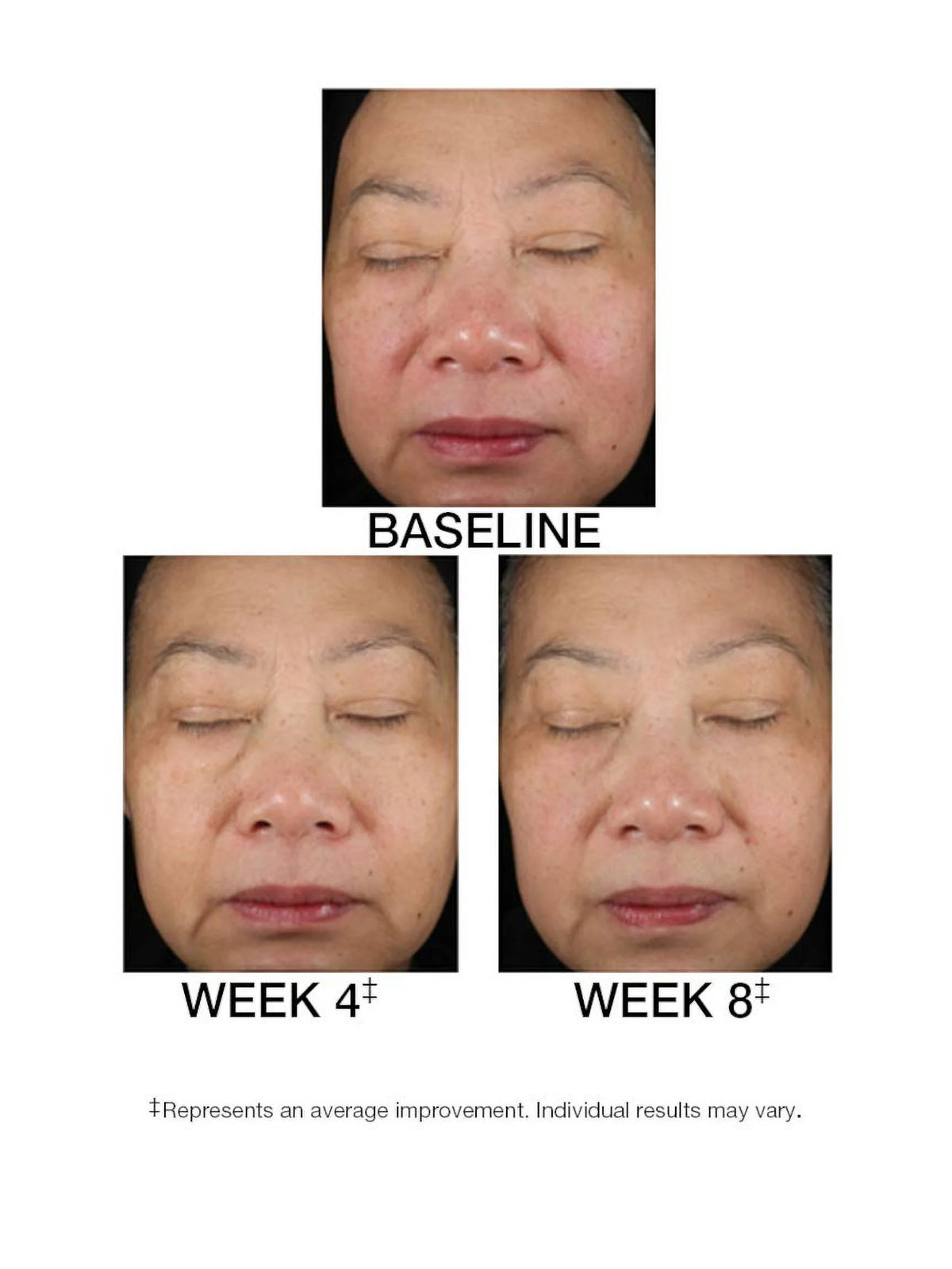 1.5 FL. OZ. Serum T801